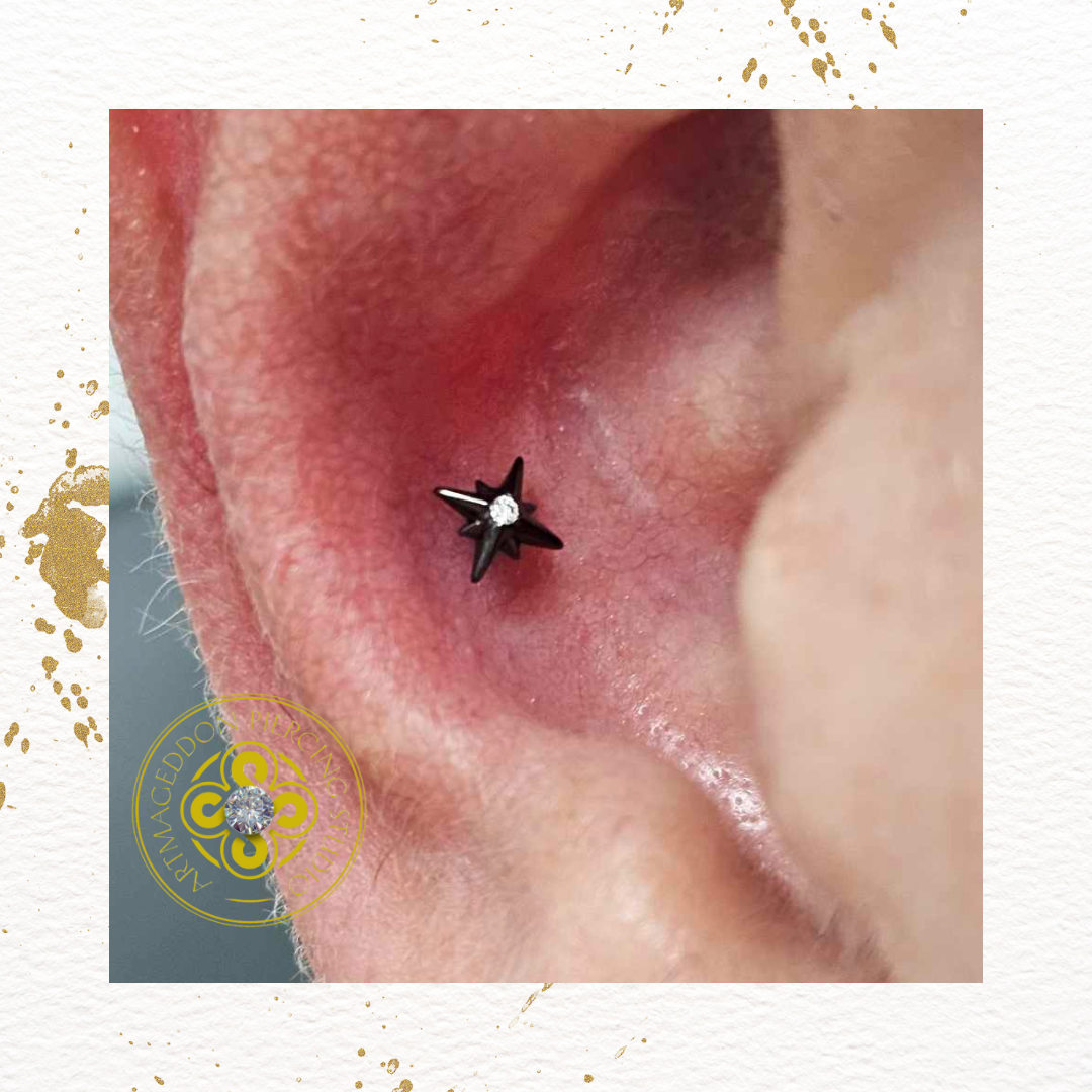 Scene Stella Threadless End